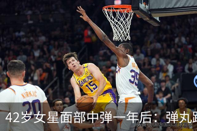 42岁女星面部中弹一年后：弹丸距眼球1毫米，一动就失明